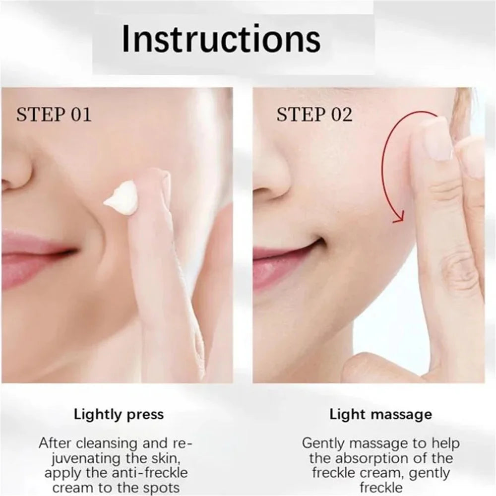 Powerful Spot-Removing Whiten Cream Brighten Skin Fast Eliminates Melanin Pigmentation Melasma Dark Spots Korean Face Skin Care