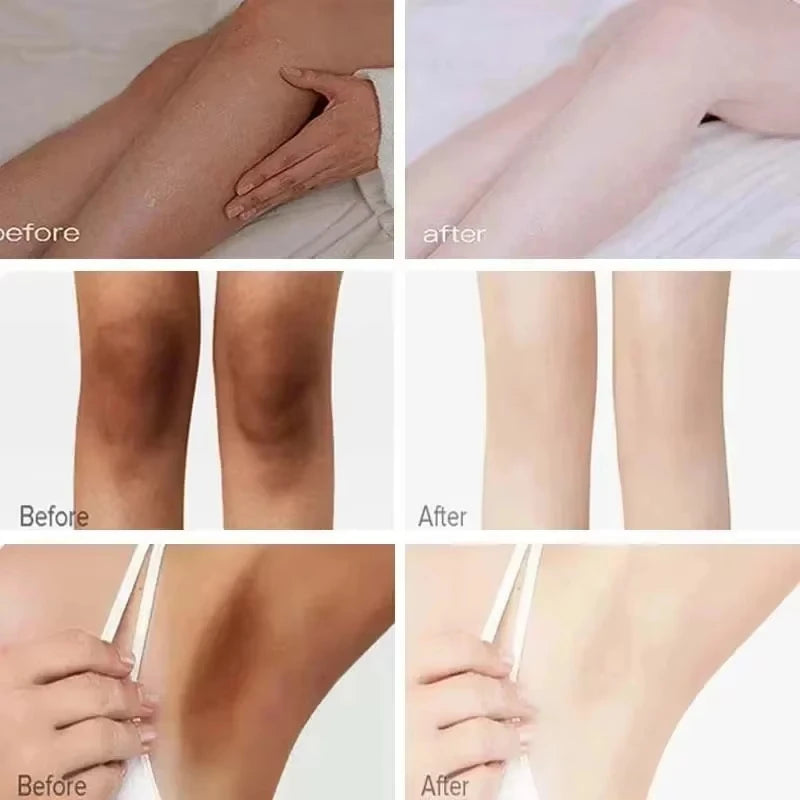Body Whitening Cream Arms Thighs Underarm Knees Whitening Essence Cream Brighten Moisturizing Body Korean Skin Care Products