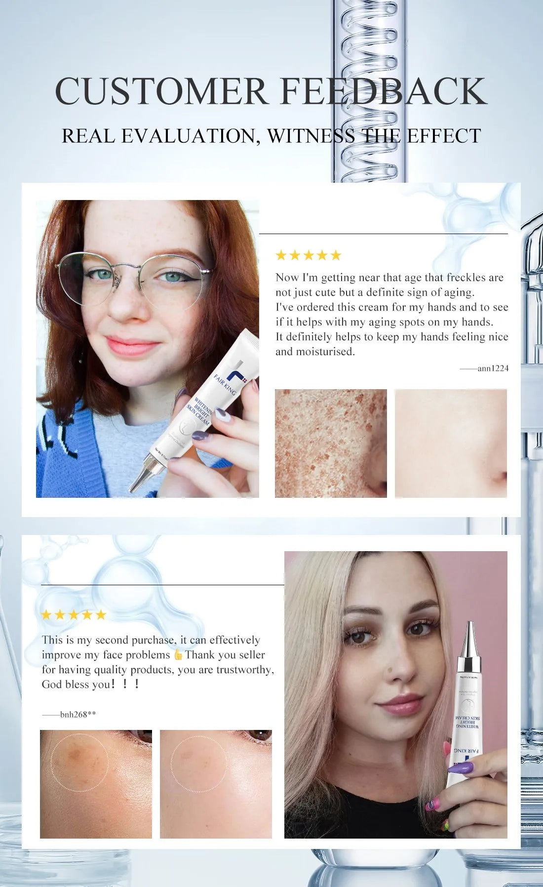 FAIRKING Spot Cream Remove Chloasma Eliminate Dark Spots Brighten Skin Tone Face Skin Care Products Improves Dull Skin