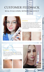 FAIRKING Spot Cream Remove Chloasma Eliminate Dark Spots Brighten Skin Tone Face Skin Care Products Improves Dull Skin