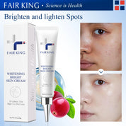 FAIRKING Spot Cream Remove Chloasma Eliminate Dark Spots Brighten Skin Tone Face Skin Care Products Improves Dull Skin