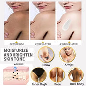 Body Whitening Cream Arms Thighs Underarm Knees Whitening Essence Cream Brighten Moisturizing Body Korean Skin Care Products