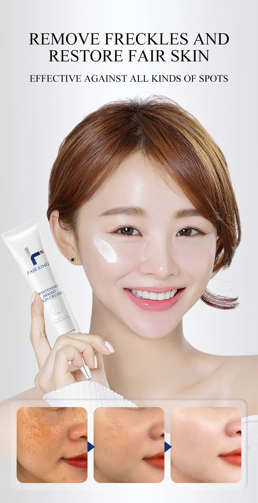 FAIRKING Spot Cream Remove Chloasma Eliminate Dark Spots Brighten Skin Tone Face Skin Care Products Improves Dull Skin