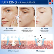 FAIRKING Spot Cream Remove Chloasma Eliminate Dark Spots Brighten Skin Tone Face Skin Care Products Improves Dull Skin