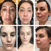 Powerful Spot-Removing Whiten Cream Brighten Skin Fast Eliminates Melanin Pigmentation Melasma Dark Spots Korean Face Skin Care
