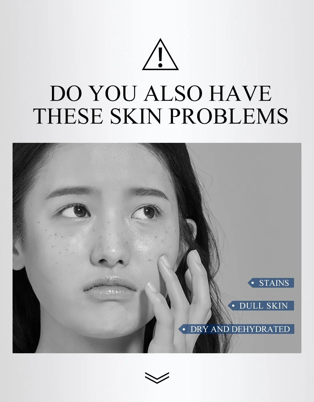 FAIRKING Spot Cream Remove Chloasma Eliminate Dark Spots Brighten Skin Tone Face Skin Care Products Improves Dull Skin