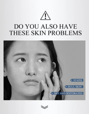 FAIRKING Spot Cream Remove Chloasma Eliminate Dark Spots Brighten Skin Tone Face Skin Care Products Improves Dull Skin