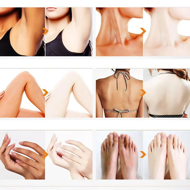 Body Whitening Cream Arms Thighs Underarm Knees Whitening Essence Cream Brighten Moisturizing Body Korean Skin Care Products